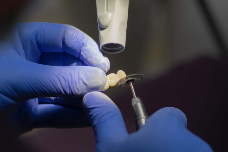 Ranking implantów zębowych – najważniejsze informacje